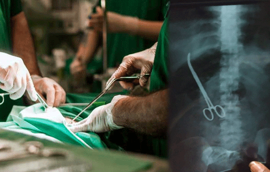 Doctors at Hyderabad NIMS leave forceps in patient abdomen