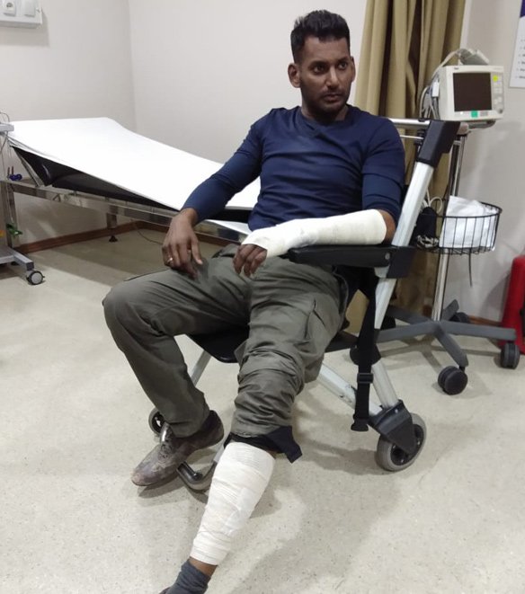 Again Vishal gets injured