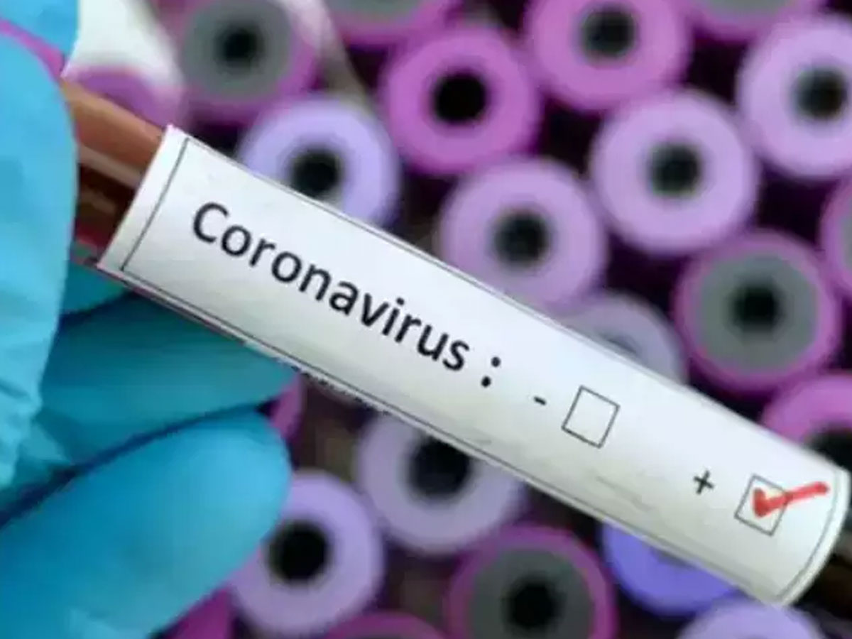 AP secretariat Employee tested Coronavirus positive