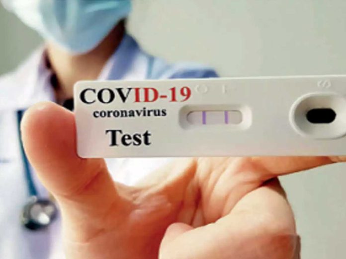 Rapid-Antigen Test self-kit is the perfect resolution for Covid test
