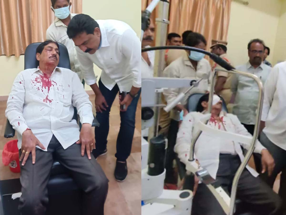 Attack on TDP leader, lost his eye
