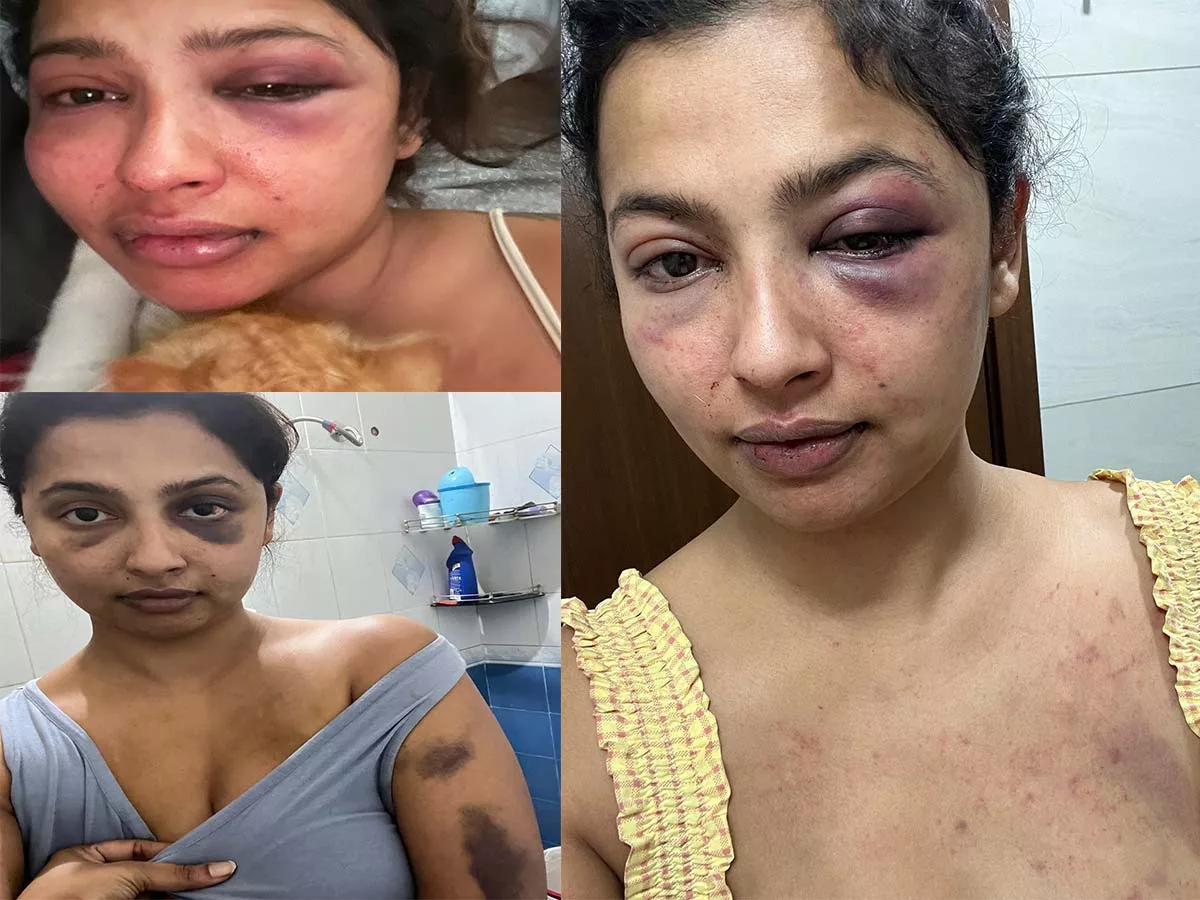 Boyfriend beats South actress, her face is swollen