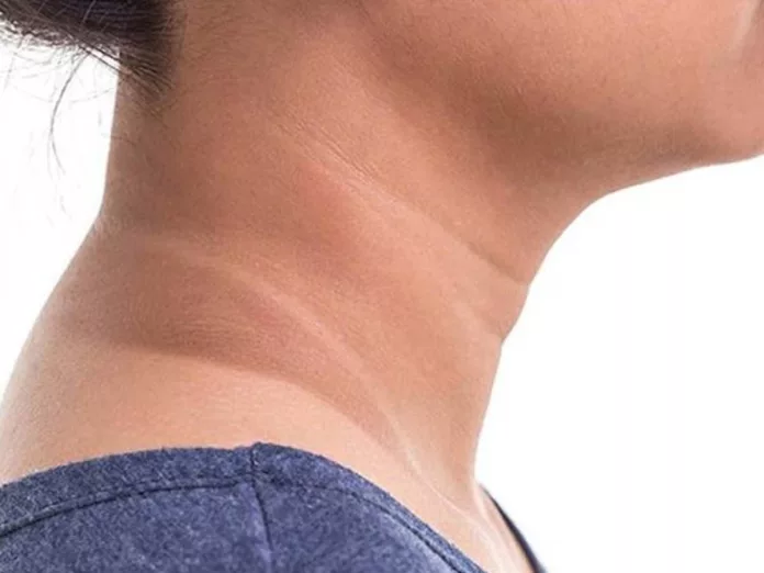 Suffering from dark neck problems? Follow these tips!