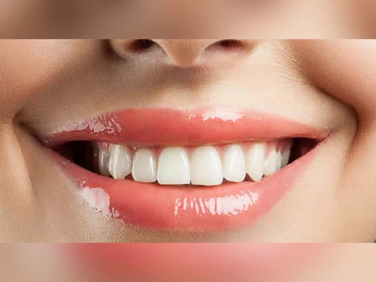 Teeth Health: Bye bye yellow teeth, the ways to get pearly white teeth