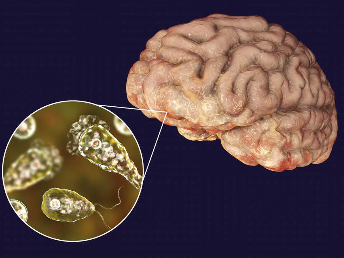 Brain Eating Amoeba: What is primary amoebic meningoencephalitis? Do not ignore these symptoms