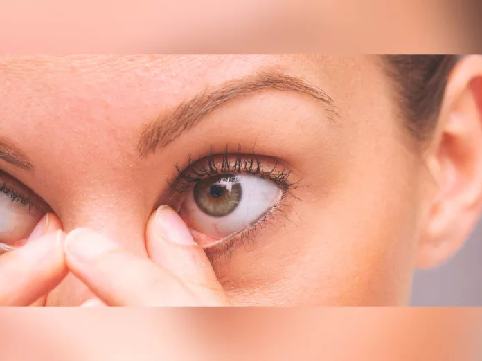 Improve Eyesight naturally: Are your eyes often blurry? How to cure blurry vision naturally?