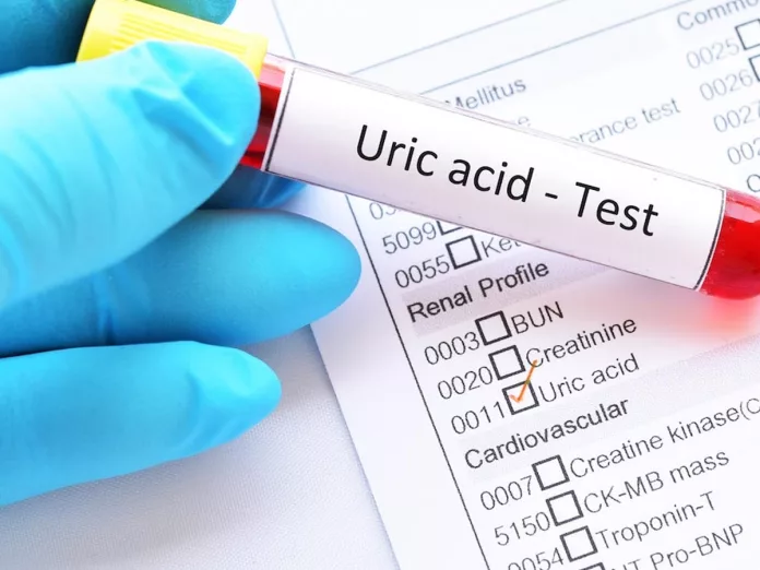 Uric Acid: If these symptoms appear then it can be a problem of uric acid
