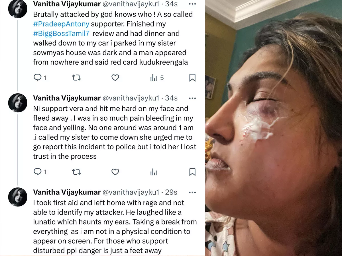Actress Vanitha Vijayakumar attacked by mysterious person